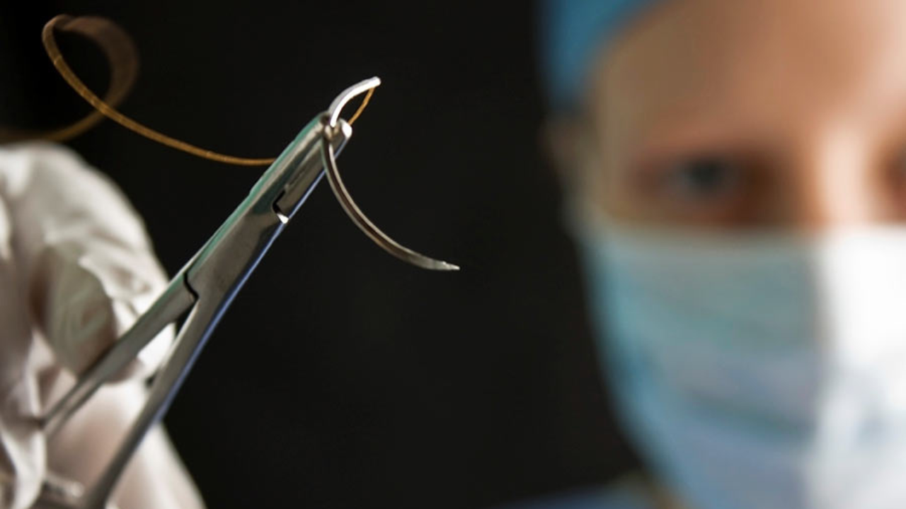 Doctor leaves surgical needle inside head of girl